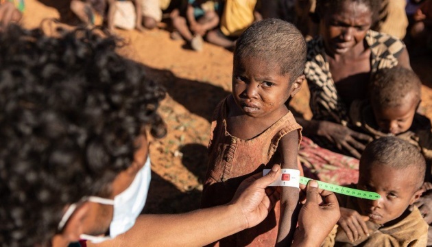 Голодна смерть загрожує восьми мільйонам дітей у 15 країнах світу – ЮНІСЕФ