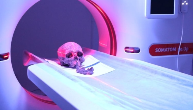 Належав 25-річному чоловіку: у Тернополі археологи сканували череп, якому три тисячі років
