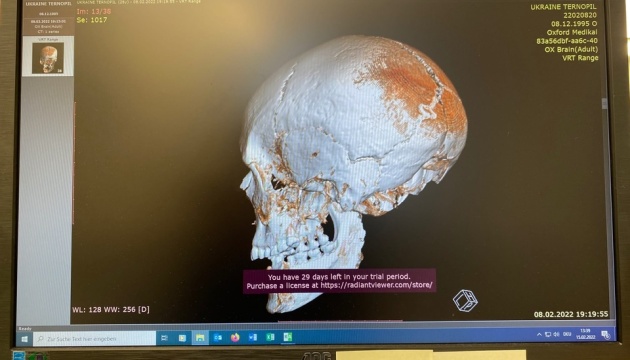 Німецькі антропологи відтворюють обличчя давньої людини для музею на Тернопільщині