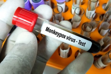Second case of monkeypox recorded in Ukraine