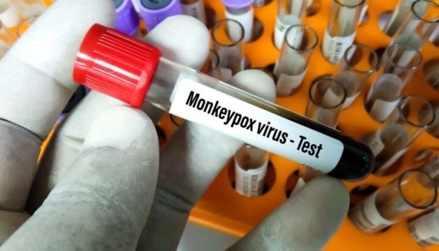 First monkeypox case confirmed in Ukraine
