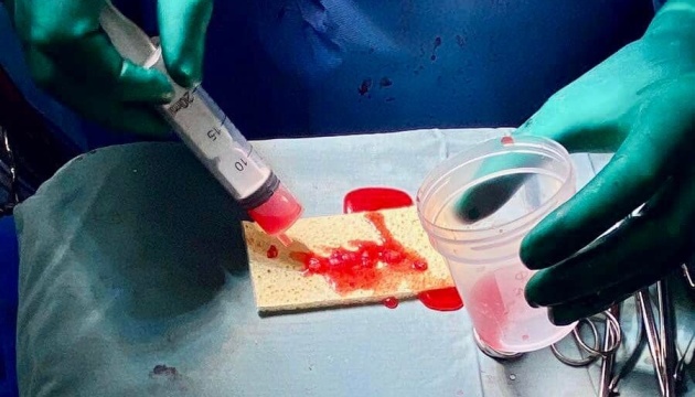 У Львові вперше провели трансплантацію стовбурових клітин