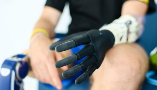Во Львове установили первый бионический протез руки