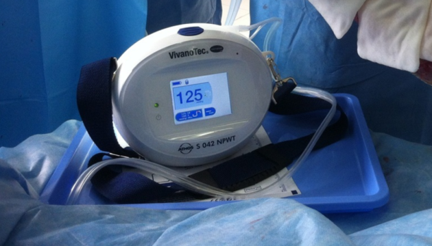 Україна на гроші від United24 закупила 22 апарати вакуумної терапії ран