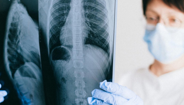 Українські лікарні отримали близько 30 портативних рентген-систем і сучасних рентгенів