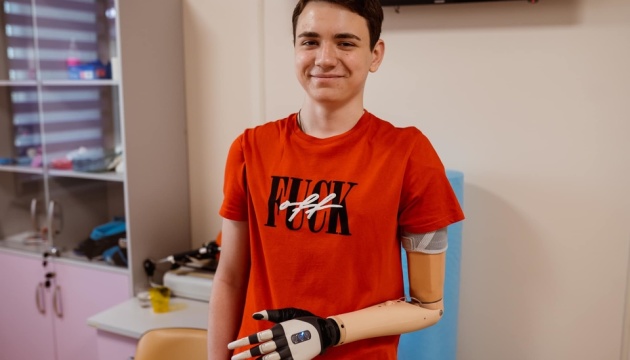 Втратив руку через обстріл росіян: підліток з Херсонщини отримав біонічний протез