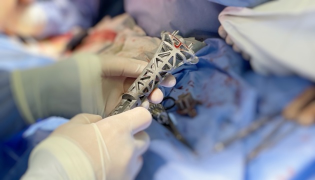 У Львові хлопчику із саркомою Юїнга трансплантували кістку, надруковану на 3D-принтері