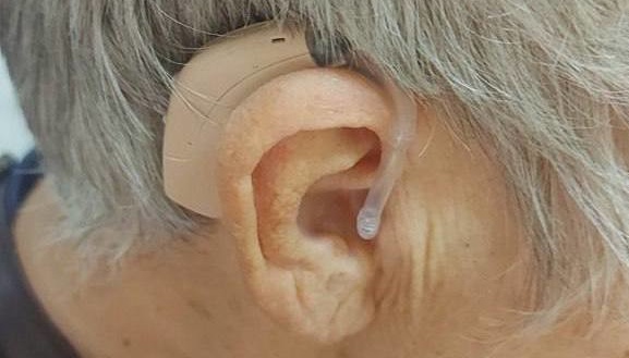 На Херсонщині 40 мешканців деокупованих територій отримали слухові протези