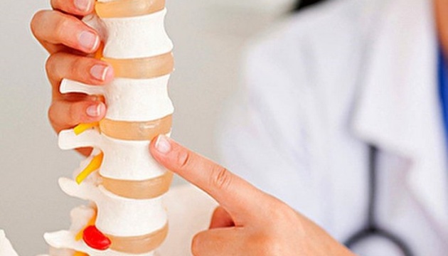 Чи можна запобігти розвитку остеопорозу: поради ендокринолога