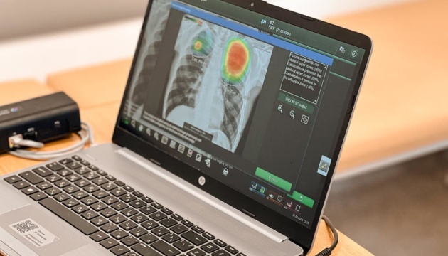 В Івано-Франківську штучний інтелект аналізуватиме рентгенівські знімки