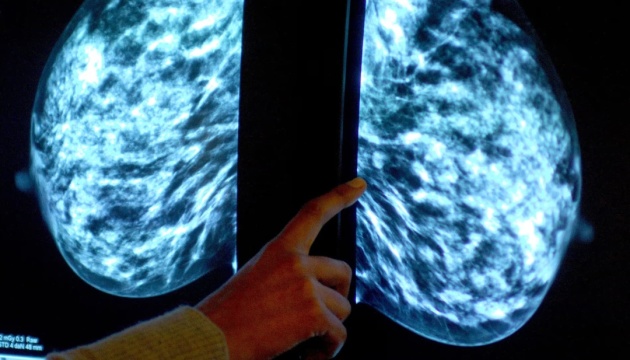 У Британії розробляють пристрій для моніторингу пухлини раку молочної залози