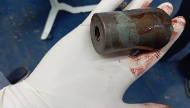 З ноги пораненого військового вилучили частину касетного боєприпасу - Медичні сили ЗСУ