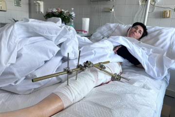 露軍攻撃で負傷したウクルインフォルムのズヴォナリョヴァ記者の容体安定