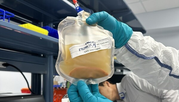 Науковці випробовують метод вирощування печінки у лімфовузлах людини