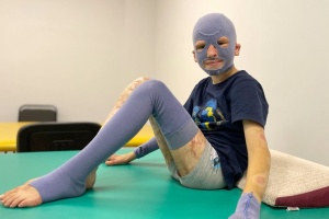 Хлопчику, який постраждав від російського ракетного удару по Вінниці, провели 37-му операцію