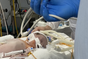 A Life Symphony Performed by Ukrainian Surgeons on The 1,000th Day of the War