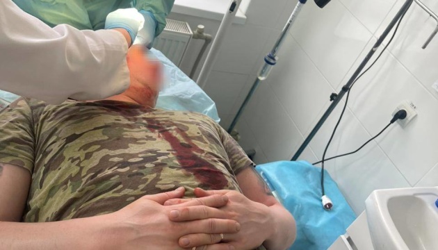 На Закарпатті місцеві жителі напали на прикордонників, двоє охоронців кордону - в лікарні