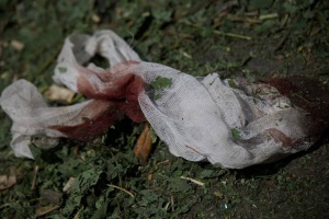 Injury toll in missile attack on Dnipro rises to 314