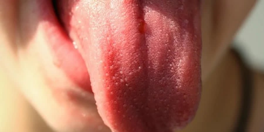 Штучний язик. Фото: pixabay