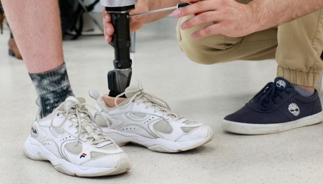 Нідерландська лабораторія поділилася з українськими фахівцями досвідом 3D-протезування