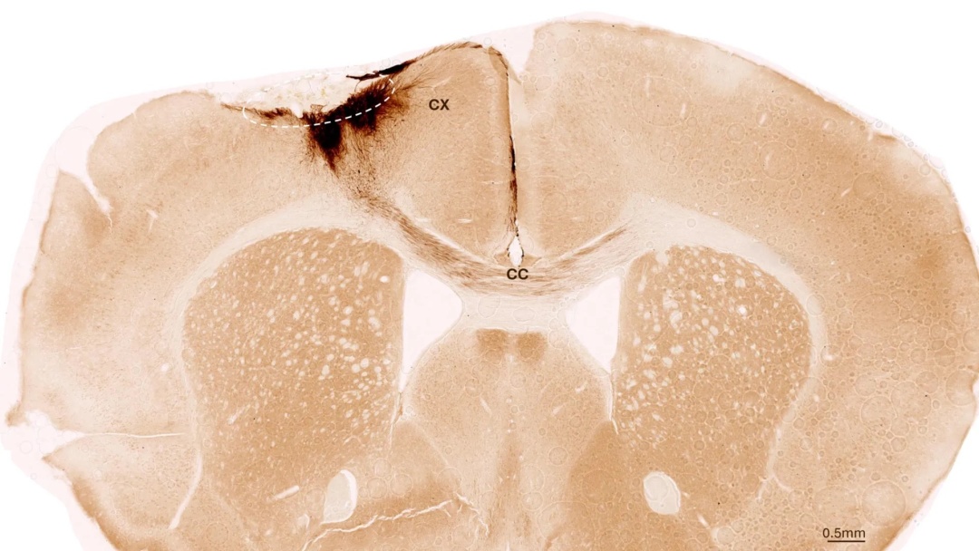 Фото: ScienceDaily