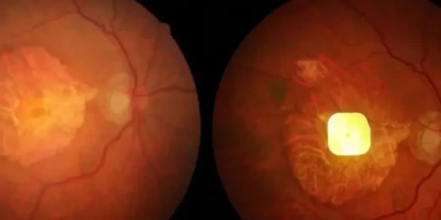 Фото: Science Corporation