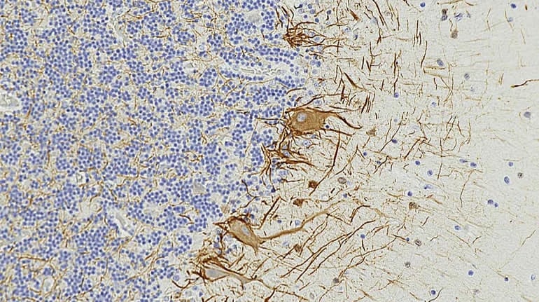 Фото: GerryShaw, Creative Commons Attribution-Share Alike 4.0 International.