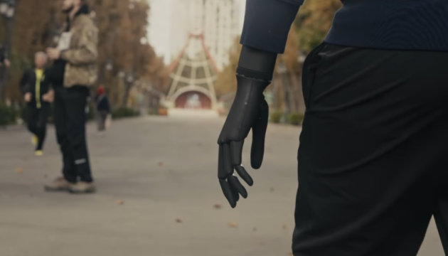 У центрі Unbroken бійцю ГУР встановили біонічний протез руки з мультиартикуляційною кистю