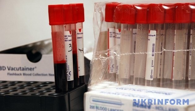 У Росії критична ситуація з поширенням ВІЛ-інфекції - розвідка