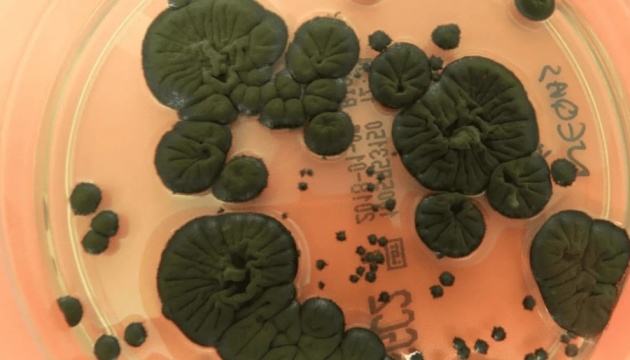 Чорна пліснява з Чорнобиля може стати біологічним захистом для космонавтів