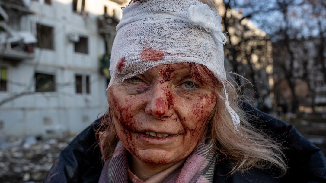 Фото: Wolfgang Schwan/Anadolu Agency