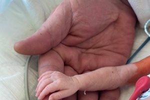 В Інституті серця успішно прооперували немовля вагою 1100 грамів