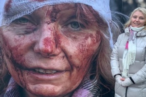 Woman known as ‘first face of war’ takes up work in civic organization