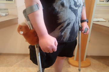 У Харкові вперше провели остеоінтеграційне протезування ветеранам