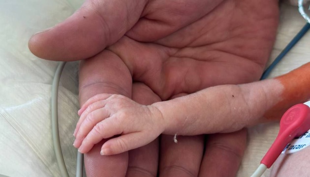 В Інституті серця успішно прооперували немовля вагою 1100 грамів