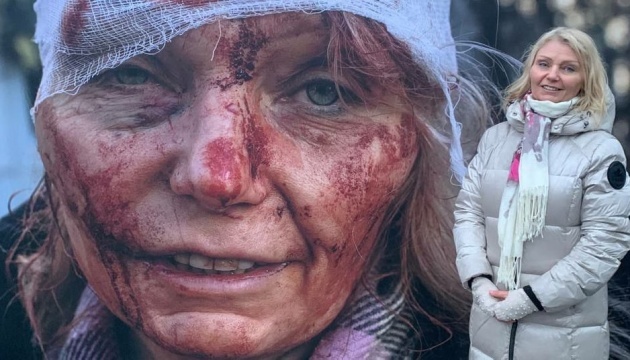 Woman known as ‘first face of war’ takes up work in civic organization