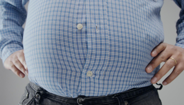 В Україні понад 1 мільйон людей мають діагноз «ожиріння» або «надлишкова вага»