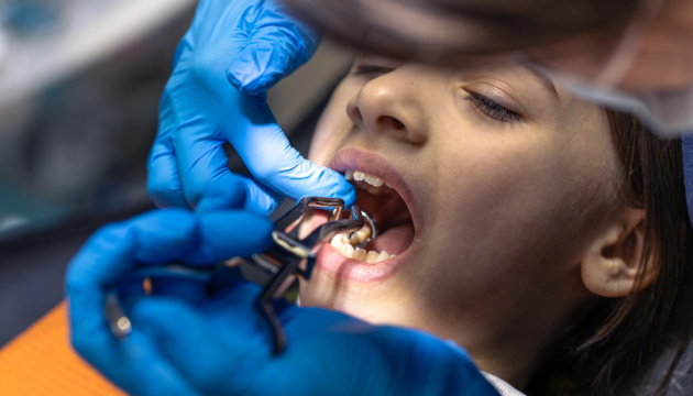 В Україні 90% дітей мають карієс - медики