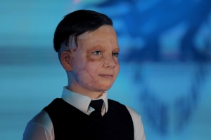 Одинадцятирічний пацієнт Unbroken візьме участь у світовому марафоні в Бостоні