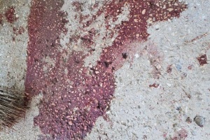 ロシア軍、ヘルソン中心部の病院を無人機で攻撃　職員４人が負傷