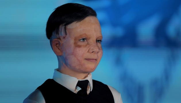 Одинадцятирічний пацієнт Unbroken візьме участь у світовому марафоні в Бостоні