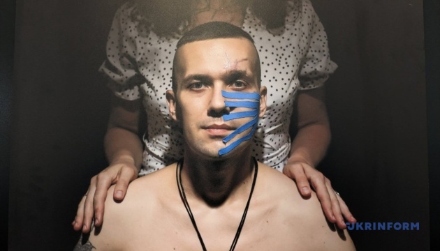 Фотокореспондентка Укрінформу показала у Брюсселі портрети реабілітованих військових та цивільних