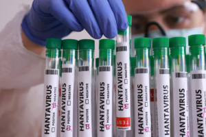 Russian propaganda invents fake hantavirus 'outbreak' among Ukrainian soldiers