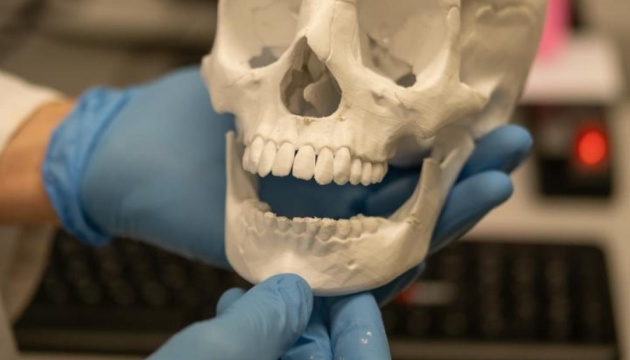 У Чехії розробляють технологію 3D-друку кісток